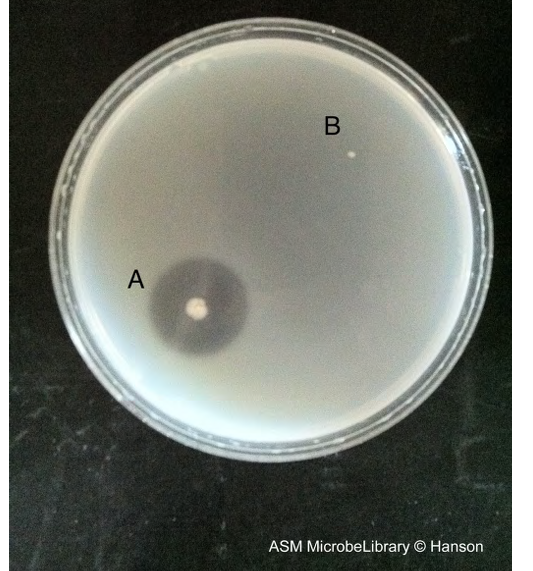 <p>In a <em>negative</em> gelatinase test (locate a pinpoint colony B), what happens when HCl is added to the plate?</p><p>a. The entire plate remains clear, including the area around the colony.</p><p>b. The plate turns brown.</p><p>c. The entire plate turns black.</p><p>d. The entire plate, including the area around the colony, turns opaque.</p>