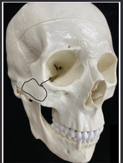 <p>What bone is this?</p>