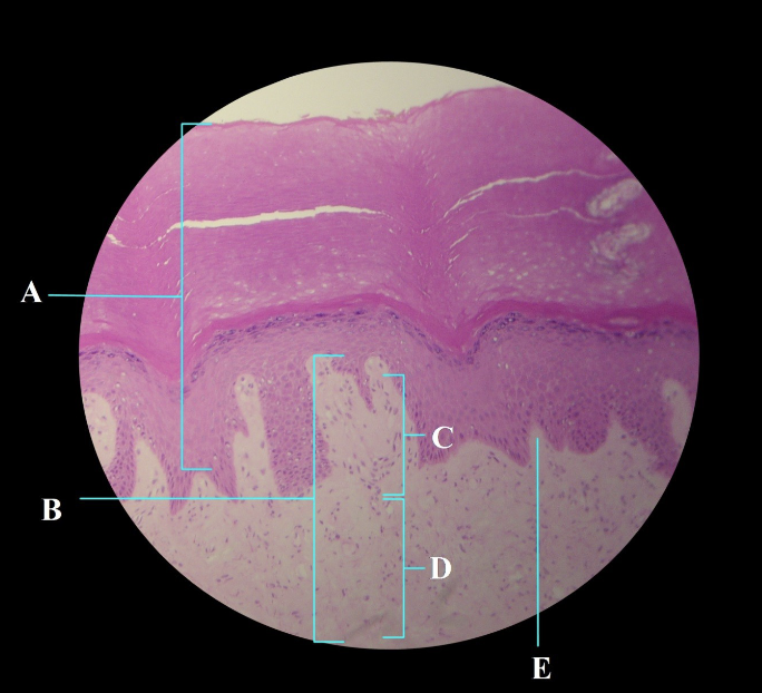 term image