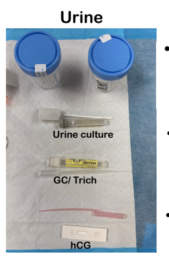 <p>Collecting urine:</p><p>General Collection (Clean Catch Mid-Stream)</p><p></p><p><strong>Male Anatomy</strong>: Wipe once, then perform a mid-stream catch.</p><p></p><p><strong>Female Anatomy</strong>: Wipe three times (right, left, middle) from front to back, then perform a mid-stream catch</p><p></p><p>Actual Procedure:</p><ul><li><p>Remove the top of the tube.</p><p></p></li><li><p>Use pipette to draw up urine to the fill area of the tube (2mL).</p><p></p></li><li><p>Label the tube: Patient’s name, date, time, and initials.</p><p></p></li><li><p>Place the sample in a transport bag. Send to the lab</p></li></ul><p></p>