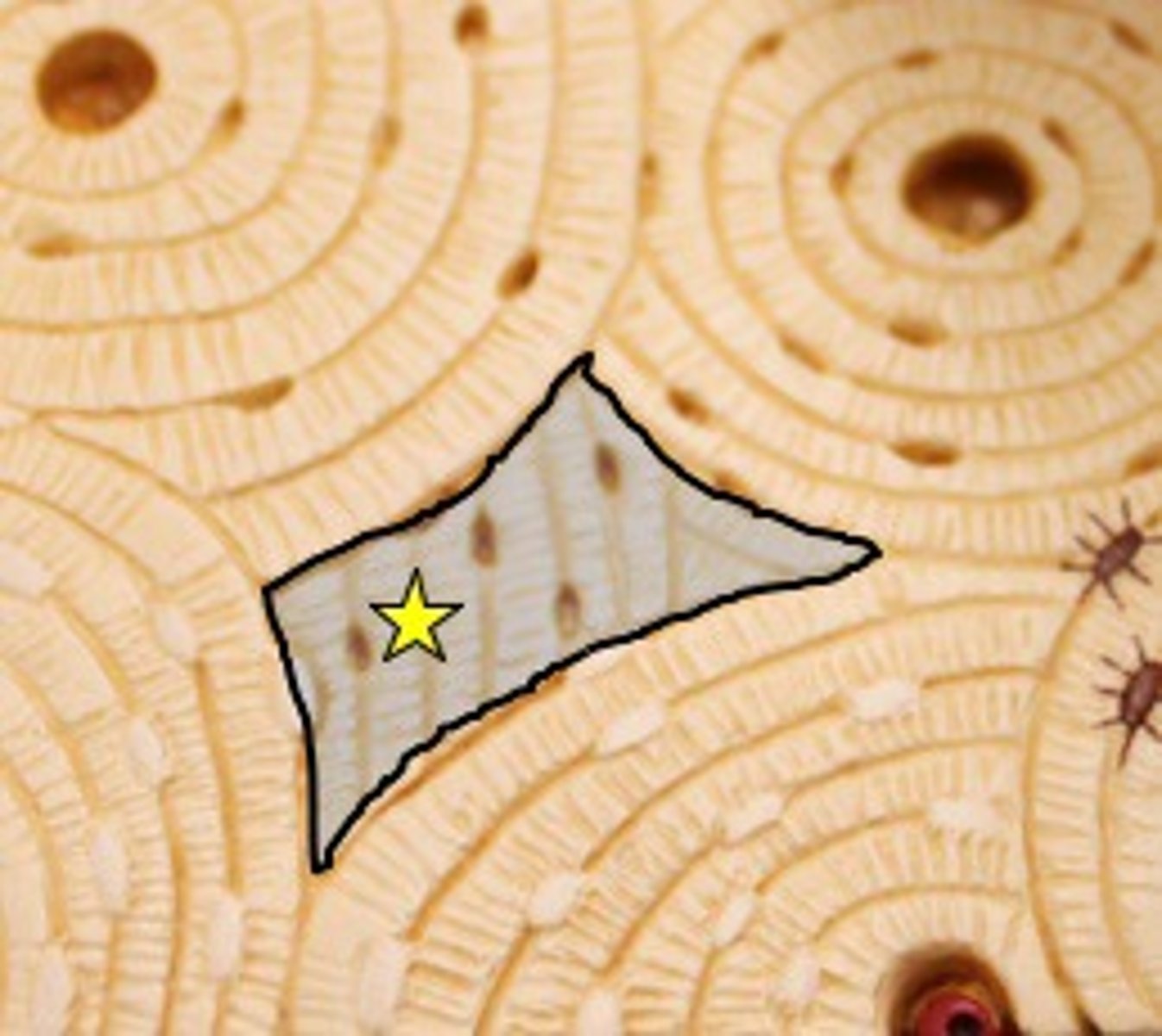 <p>remains of old osteons that broke down as bone grew and remodeled itself</p>