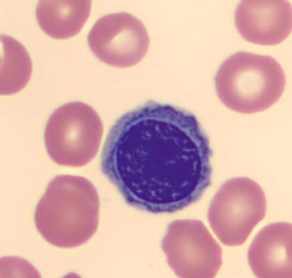 <p>nRBC or lymph?</p>