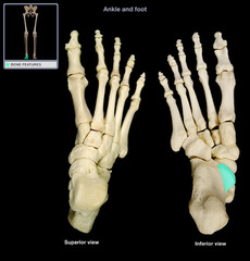 <p>plantar fascia origin</p>