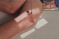 <p>SID: 40in</p><p>kVp: 70-80</p><p>Grid: depends (bigger than 4in or 10cm?)</p><p>CR: perpendicular, directed at mid-patellofemoral joint</p><p>Patient position: Flex knee only 5-10°, lateral recumbent position affected side down </p><p>Evaluation criteria: patellofemoral joint and femorotibial join demonstrated, true lateral</p>