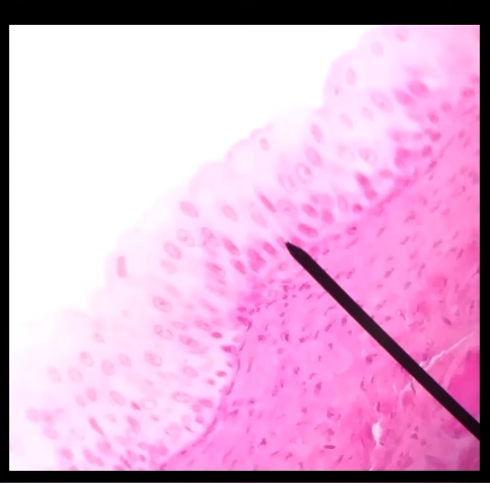 term image