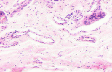 <p>soort weefsel</p>