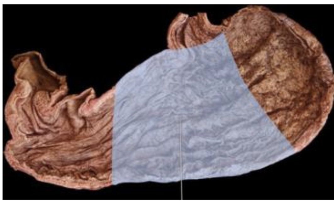 term image