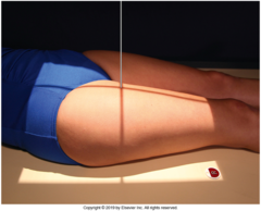 <p>kVp: 75-80</p><p>Grid: yes</p><p>CR: Perpendicular to body of femur for lower femur and neck for upper femur</p><p>Patient position: Patient Supine, leg fully extended,</p><p> Lower Femur: Internally rotate affected leg 5° for lower femur (body)</p><p>Upper Femur: rotate affected leg 15-20° internally for upper femur (neck)</p><p>Breathing instructions: suspend respiration during exposure for upper femur</p><p>Evaluation criteria: Mid-distal femur, including knee joint, for detection and evaluation of fractures or bone lesions, proximal portion includes neck and hip, fine trabecular markings</p>