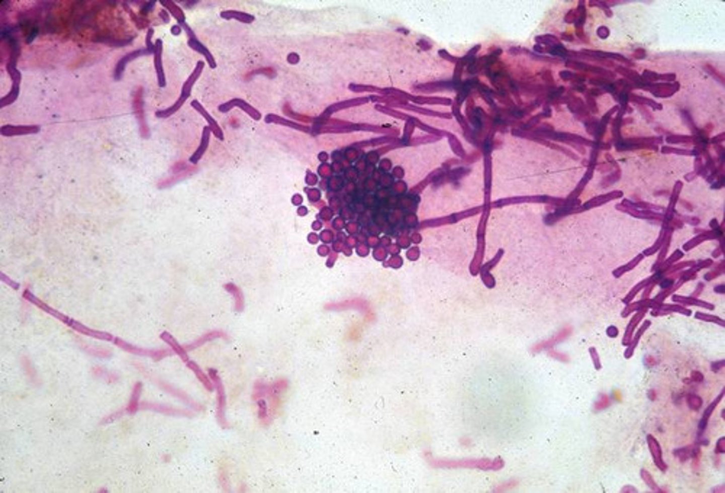 <p>Short hyphae with round yeast cells</p>