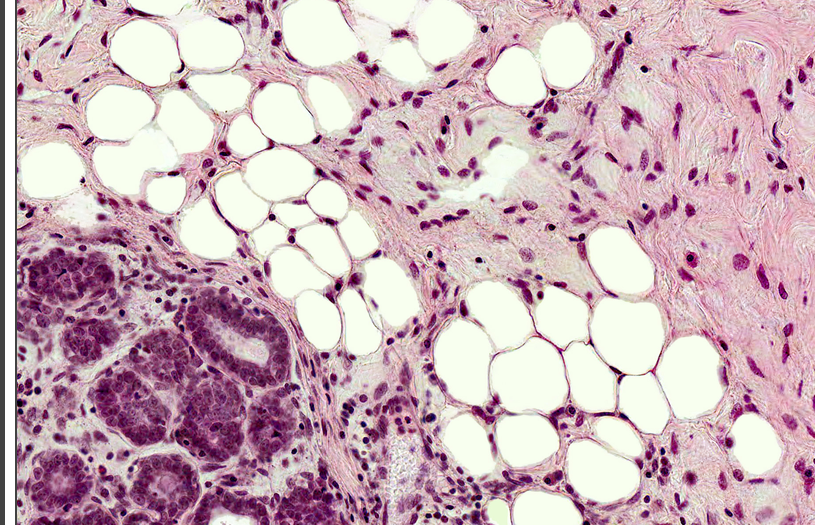 <p>what tissue type is this</p>