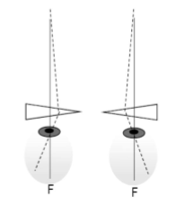 <p>convergence. displaces the image to the <strong>temporal retina</strong></p><p></p><ul><li><p>can keep increasing base out prism power until the limit of convergence is reached (diplopia) </p></li></ul><p></p>