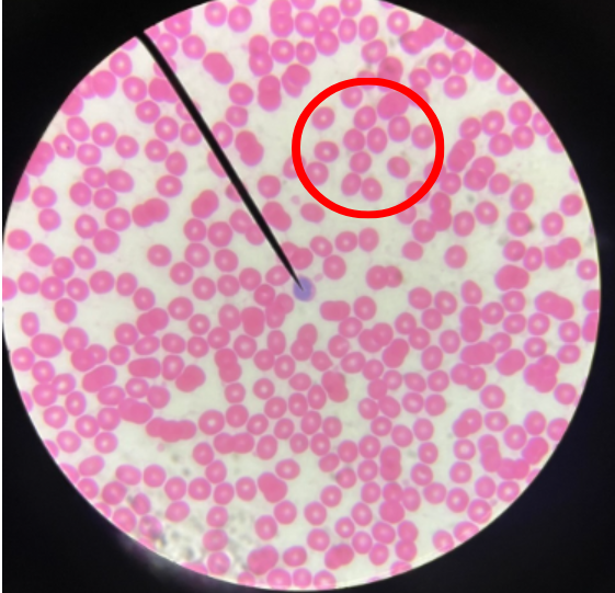 <ol><li><p>What cells is the Red Circle referring to?</p></li><li><p>What are the specific characteristics of these cells to identify them by?</p></li></ol><p></p>