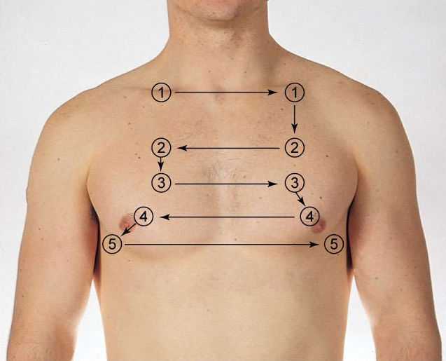<ol><li><p>Above clavicle</p></li><li><p>2nd ICS</p></li><li><p>3rd ICS</p></li><li><p>4th ICS</p></li><li><p>5th ICS</p></li><li><p>6th ICS (midaxillary)</p></li></ol><p></p>