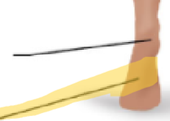 <p>What term is this? </p>