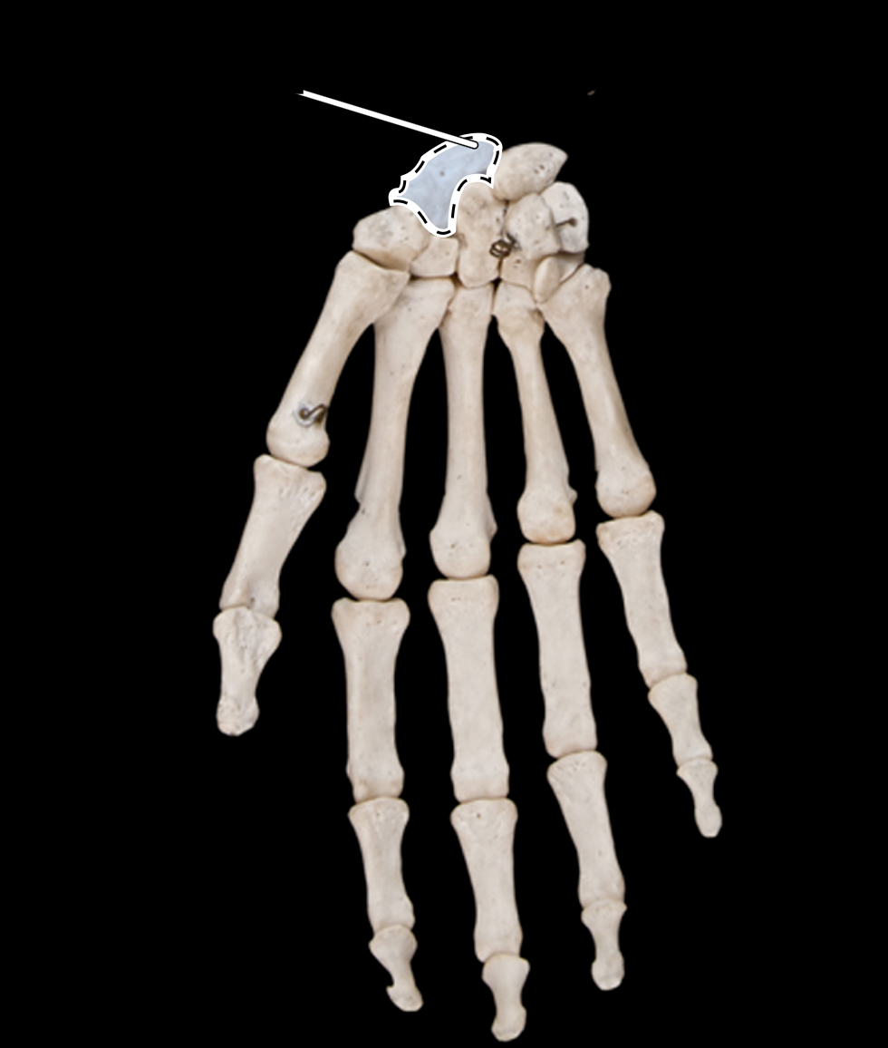 <p>anterior view</p>