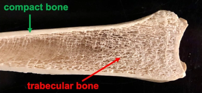 <p>Compact/cortical bone is the dense outer shell of bone. Cancellous/trabecular/spongy bone consists of small internal spicules. Either gross type may microscopically contain woven bone, lamellar bone, or a mixture.</p>