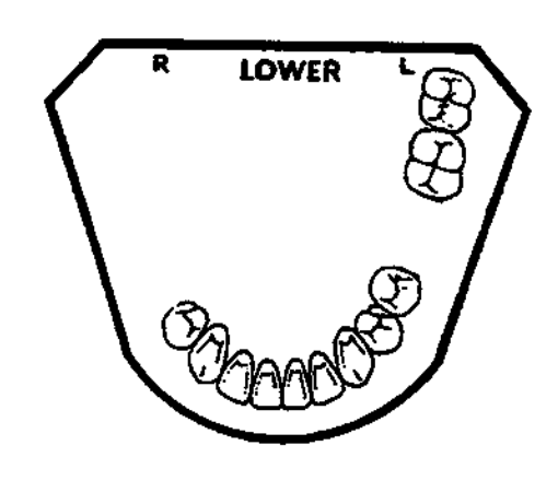 <p>classification? </p>