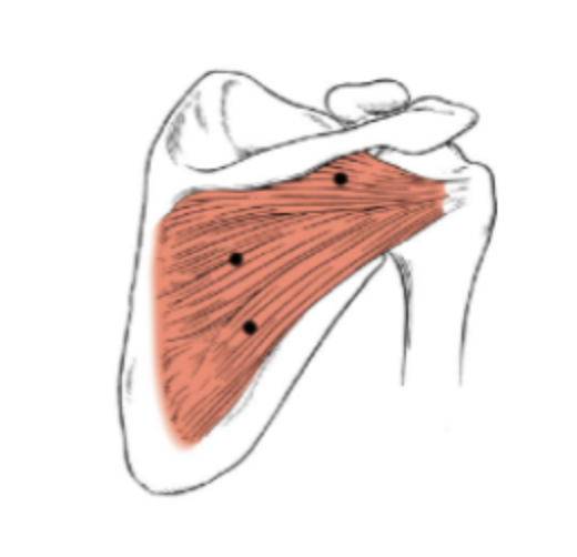 <p>What muscle is this? </p>