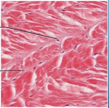 <p>NTK: what type of cartilage is this </p>