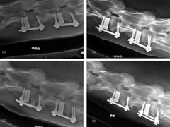 <p>What are some examples of surgical treatments for CVM (cervical vertebral myelopathy) in horses?</p>