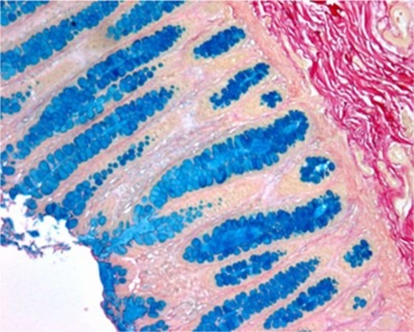 <p>colloidal iron</p><p>Feedback:</p><p>This section has been stained with the colloidal iron procedure. Aldehyde fuchsin would stain the mucin purple; toluidine blue is a met not stain mucin.</p>