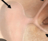 <p>What is this pointing to? What bone is it on?</p>
