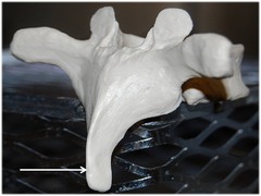 <p>Name this specific part of the thoracic vertebra.</p>