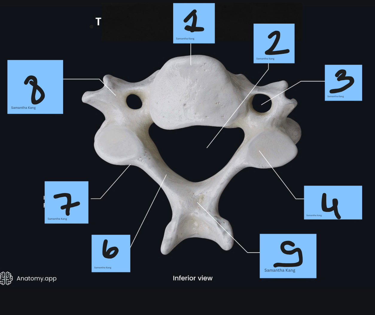 <p>What’s #8</p>