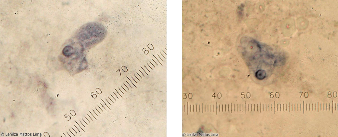 <p>Identifique e cite o habitat desse parasita</p>