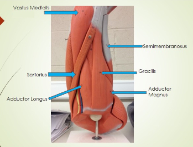 <p><span style="background-color: transparent;">Semimembranosus, </span><span style="background-color: transparent; font-family: "Times New Roman", serif;">Gracilis, Adductor Magnus, Adductor Longus, Sartorius, Vastus Medialis</span></p>