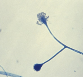 <p>Sporangia fall apart easily</p>
