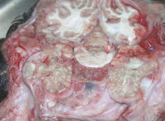 <p>What is otitis media?</p>