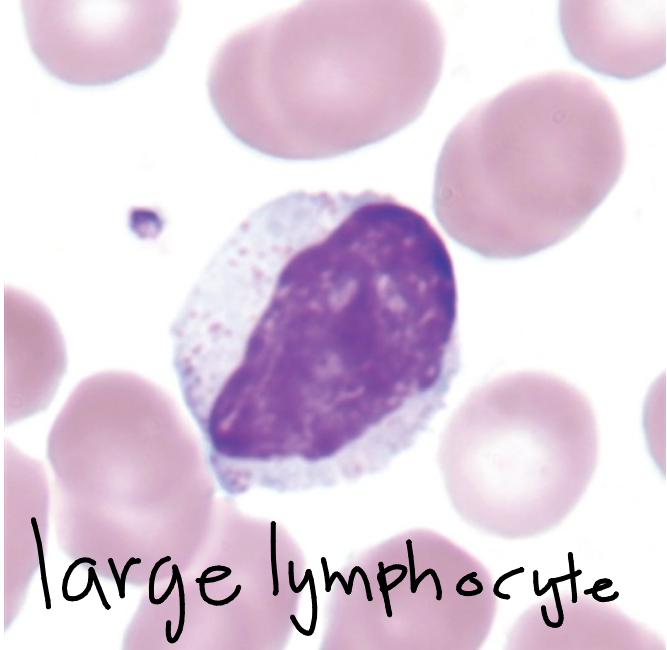 <p>Lymphocyte</p><p>7-18 micrometers, round to oval, may be slightly indented nucleus, occasional nucleoli, condensed, clumped chromatin, scant to moderate, sky blue, vacuoles may be present, NO granules in small lymphocyte; may be a few azurophilic in larger lymphocytes, N:C 5:1-2</p>