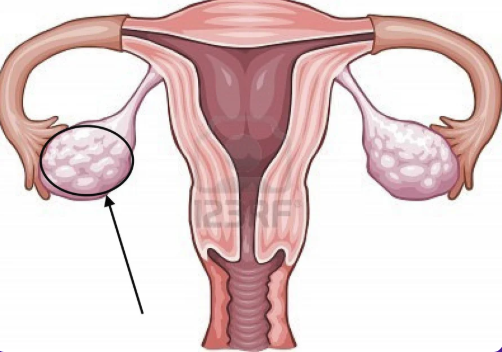 <p>what is the black arrow pointing to?</p>