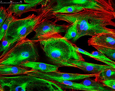 <p>cells are stained with dyes</p><p>short-wavelength (blue) light is used to excite a single plane of a specimen</p><p>each plane in a specimen is illuminated and a 3d image is constructed with a computer</p>