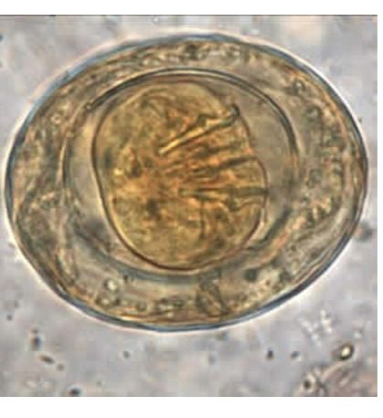 <p>-Eggs</p><ul><li><p>About 40 microns</p></li><li><p>Two shells with polar filaments between</p></li><li><p>Oncosphere has six hooklets</p></li></ul><p></p>