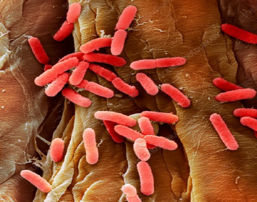 <ul><li><p>Prokaryotes</p></li><li><p>Unicellular</p></li><li><p>Example: Bacterium (<em>E. coli</em>)</p></li></ul><p></p>
