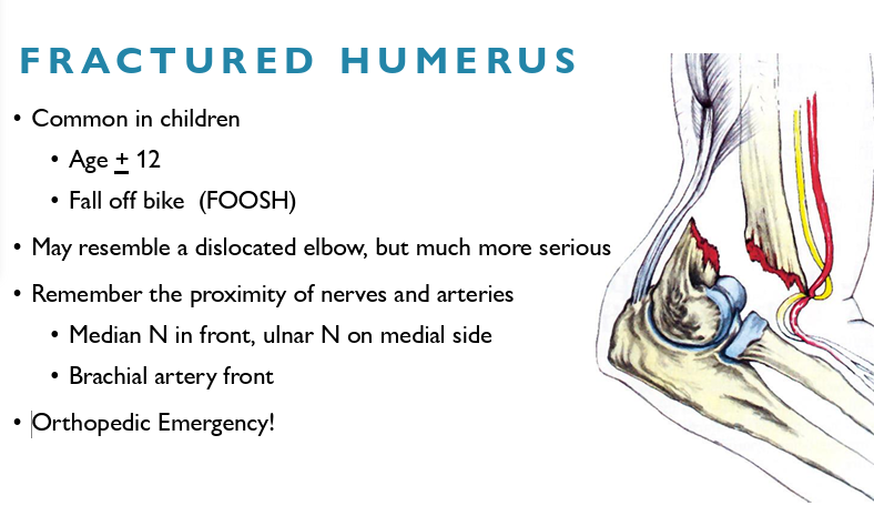 <ul><li><p>Common in children age + 12 </p></li><li><p>Fall off bike (FOOSH) </p></li><li><p>May resemble a dislocated elbow, but much more serious </p></li><li><p>Remember the proximity of nerves and arteries </p></li><li><p>Median N in front, ulnar N on medial side </p></li><li><p>Brachial artery front </p></li><li><p><strong>Orthopedic Emergency!</strong></p></li></ul><p></p>