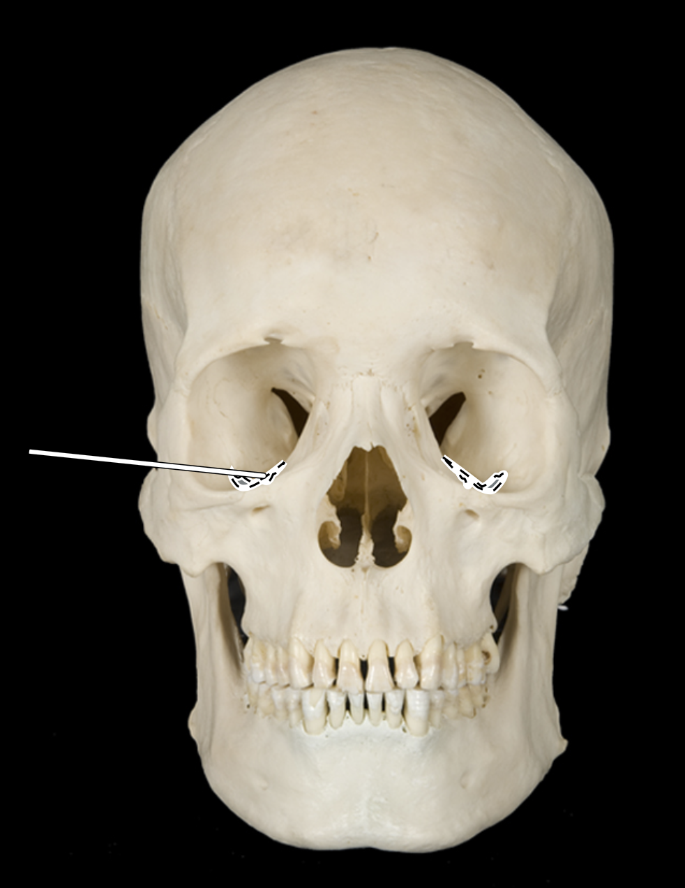 knowt flashcard image