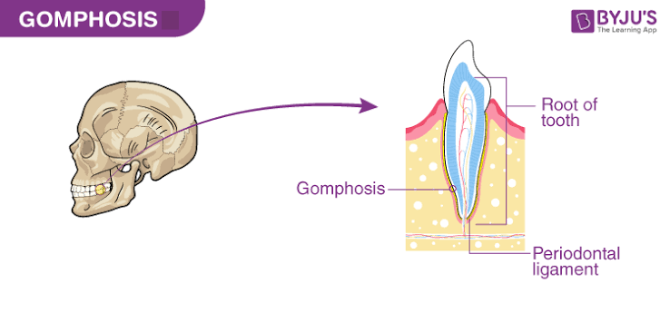 <ul><li><p>found in the maxillae and mandible where teeth are fixed securely in sockets of the alveolar margins</p></li><li><p>fibrous connective tissue between a tooth and its socket is a <strong>periodontal ligament</strong></p></li><li><p>a synarthrotic joint is sometimes called a “peg-in-socket” joint</p></li></ul><p></p>