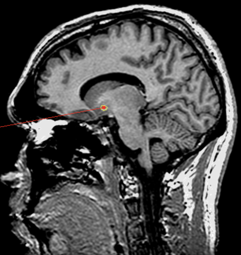 <p>What is the area highlighted called?</p>