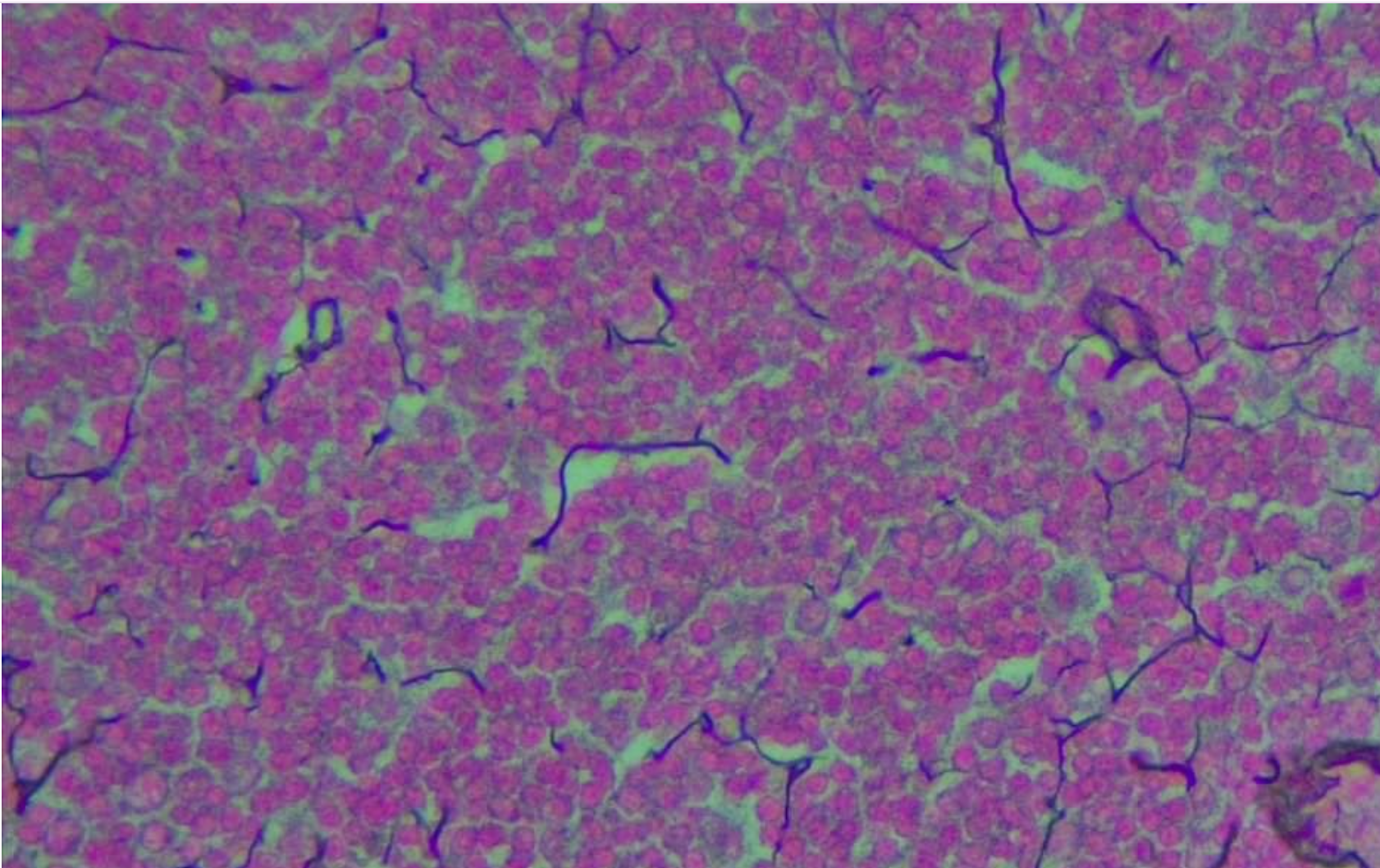 <p>Reticular Connective Tissue </p>