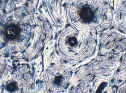 <p>tissue type </p>