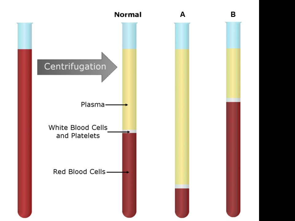 <p><span>The tube labeled "B" is most consistent with&nbsp;</span></p>