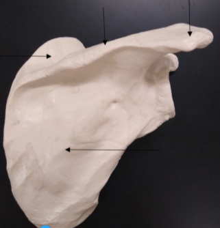 <p>What is this bone (the center of the posterior scapula)?</p>