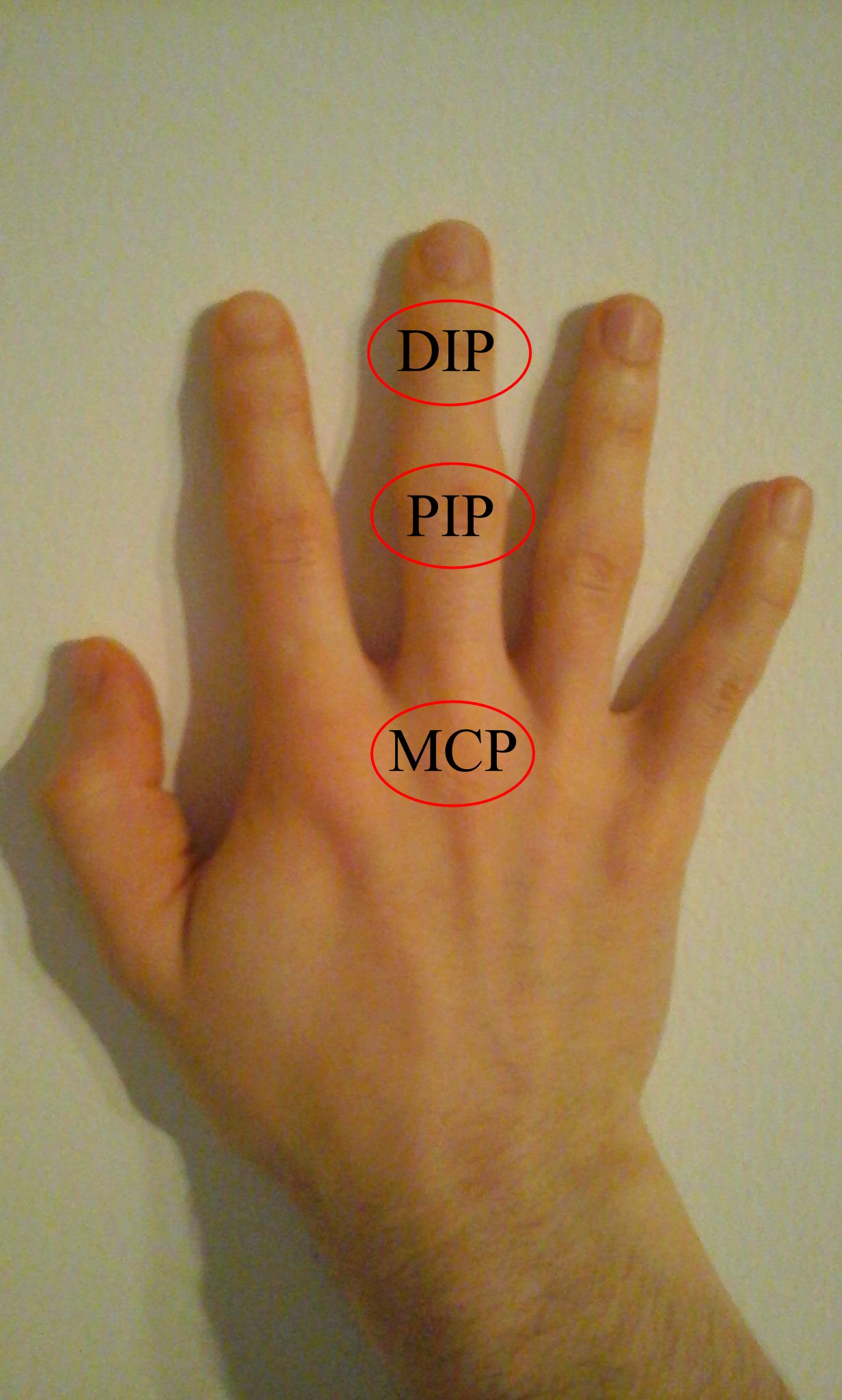 <p>Distal Interphalangeal Joint; joint between distal and middle</p>