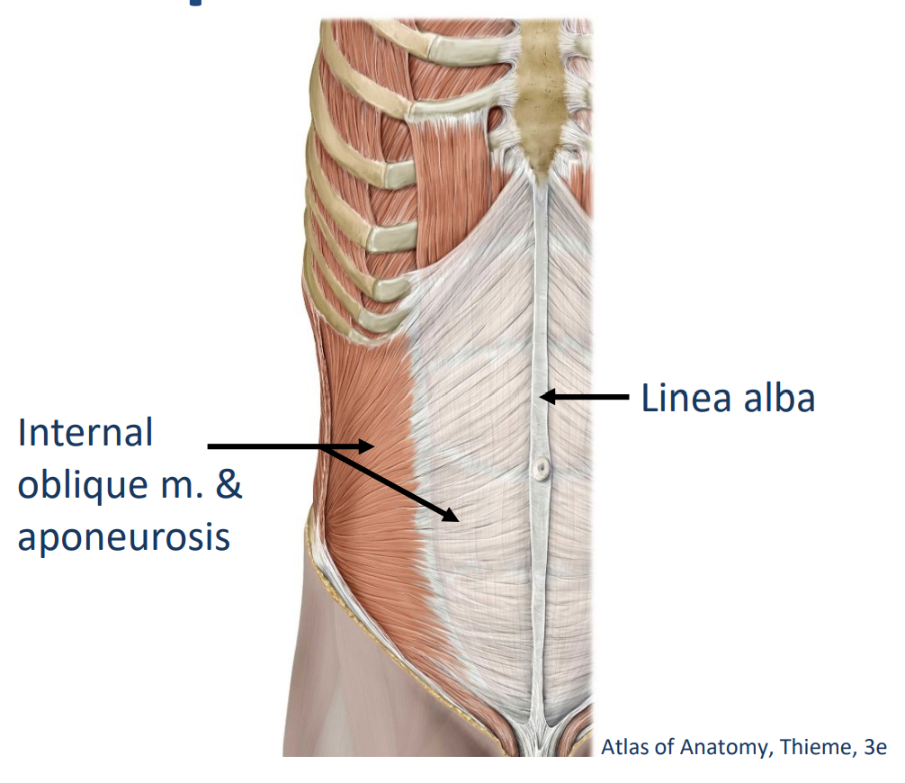 <p>Origin: Thoracolumbar fascia, ilium of pelvis</p><p>Insertion: Ribs & linea alba</p><p>.</p><p>Innervation: <span style="color: yellow;"><strong>Intercostal nn.</strong></span> (ventral rami), <span style="color: rgb(160, 228, 255);"><strong>subcostal n. (T12 ventral ramus)</strong></span>, <span style="color: rgb(234, 123, 255);"><strong>ilioinguinal n.</strong></span> (L1 ventral ramus), <span style="color: rgb(250, 115, 33);"><strong>iliohypogastric n. </strong></span>(L1 ventral ramus)</p><p>.</p><p>Actions:</p><ul><li><p>Bilateral: flex trunk, compress and support abdominal viscera, stabilize pelvis</p></li><li><p>Unilateral: ipsilateral lateral flexion & <span style="color: rgb(255, 33, 33);"><strong>ipsilateral </strong></span>rotation of trunk</p></li></ul><p></p>