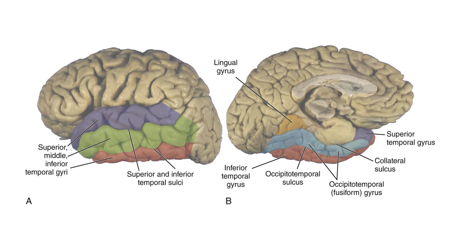 <p>Label Temporal Lobe</p><p>Medial View</p>