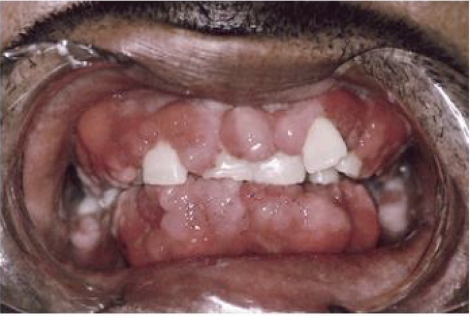 <p>CHẨN ĐOÁN</p>