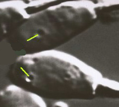 <p>What is this? Normal or abnormal sperm?</p>